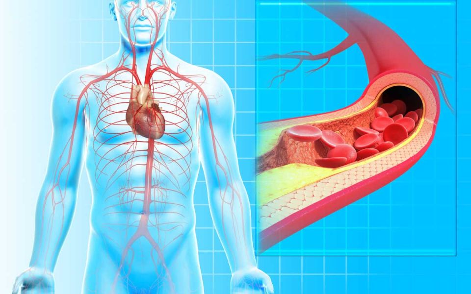 Cholesterol and the Really, Really, Really, Really Bad Cholesterol, Lp(a)