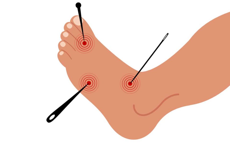 What Are the Different Types of Diabetic Neuropathy?