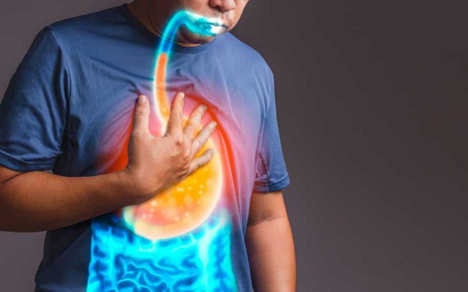 NERD - Non-Erosive Reflux Disease