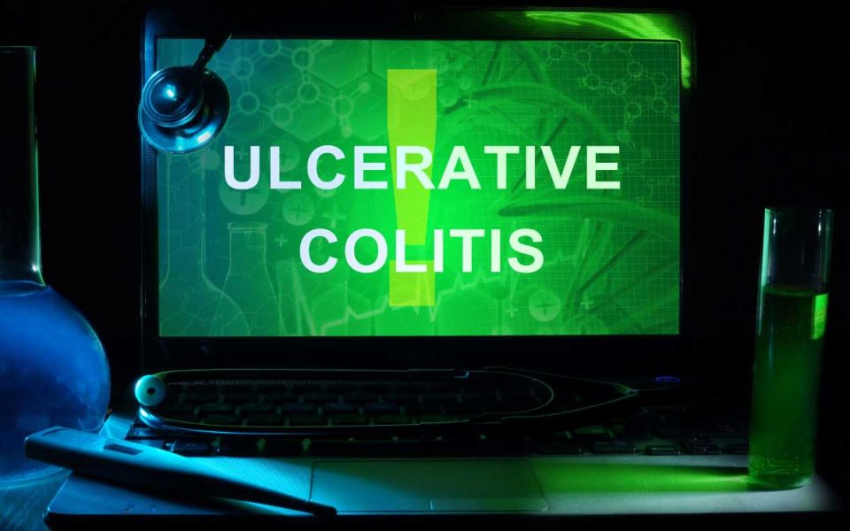 The Different types of Ulcerative Colitis