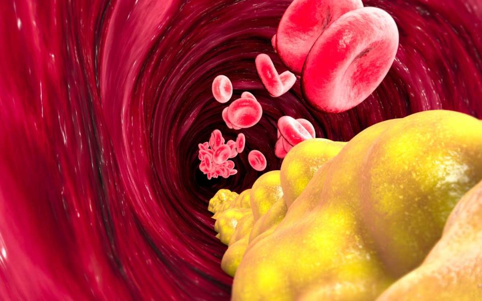 What Are Triglycerides?