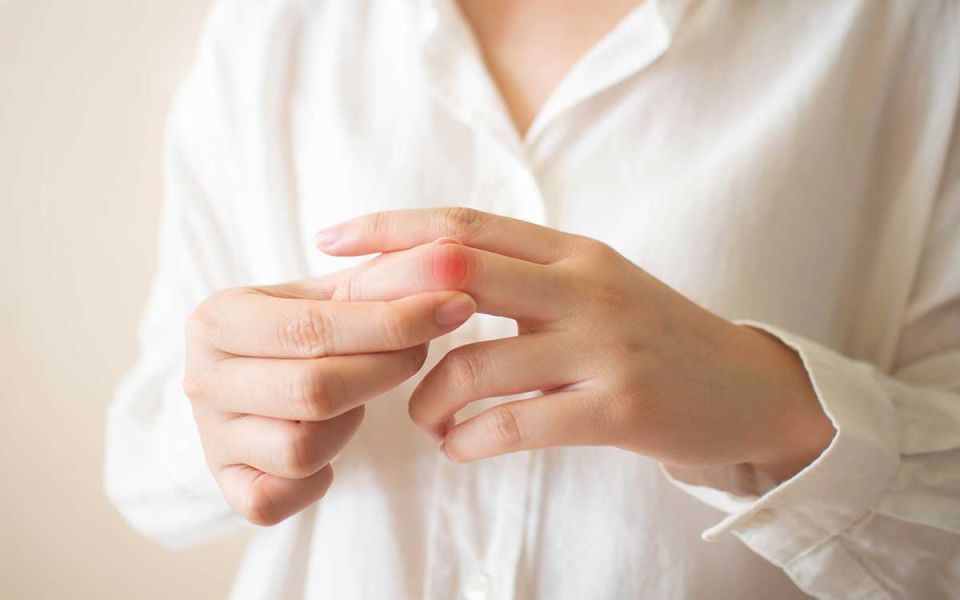 Going Beyond Skin Deep on Systemic Sclerosis