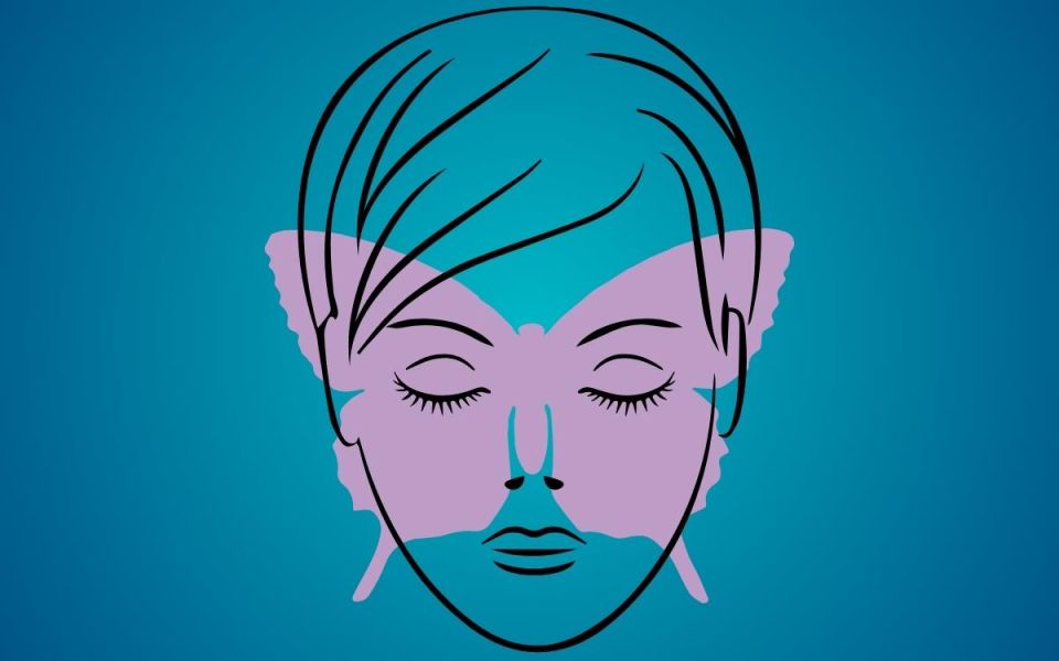 Navigating the Challenges and Treatments of Lupus