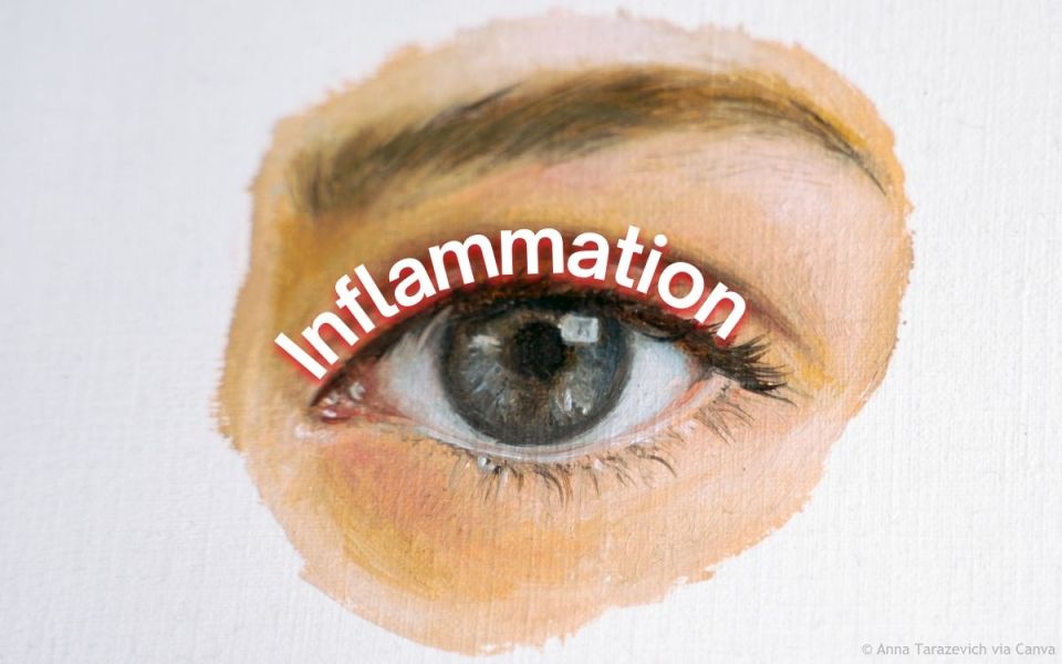 Eye-Opening Facts About Blepharitis