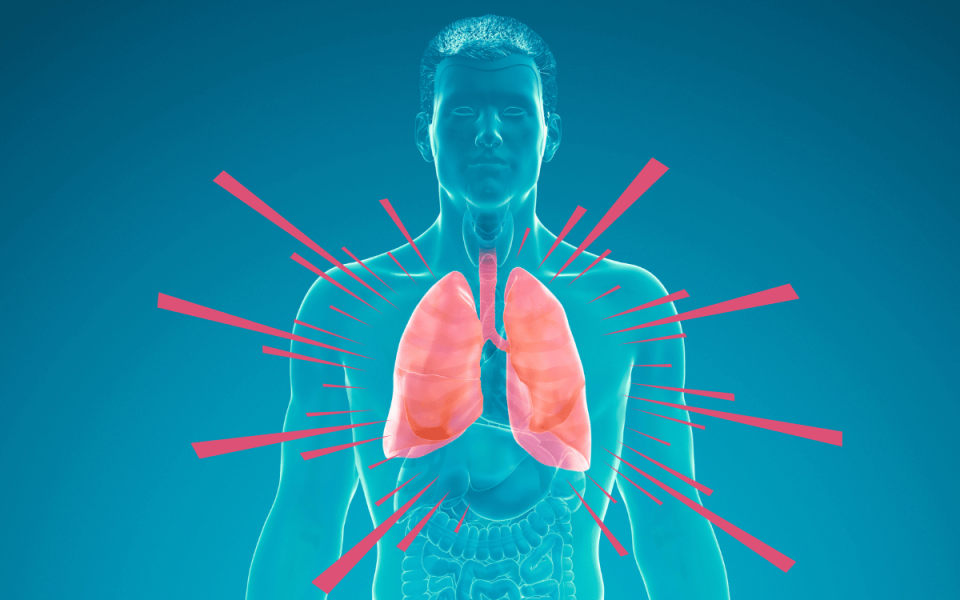 COPD Causes, Symptoms, and Modern Treatment Approaches