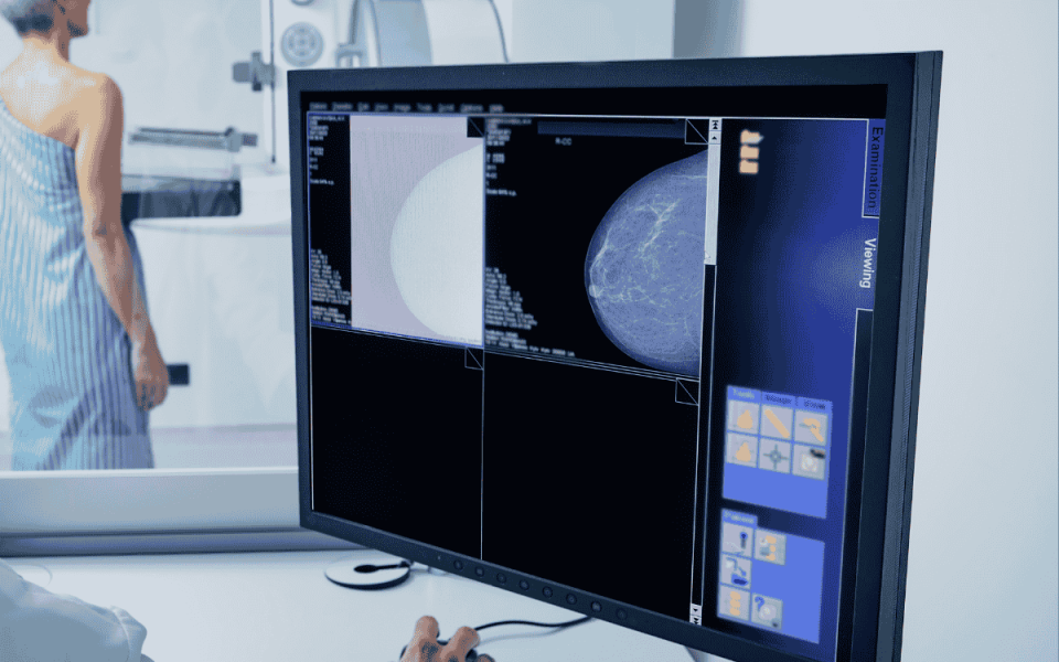 Looking Into Breast Imaging