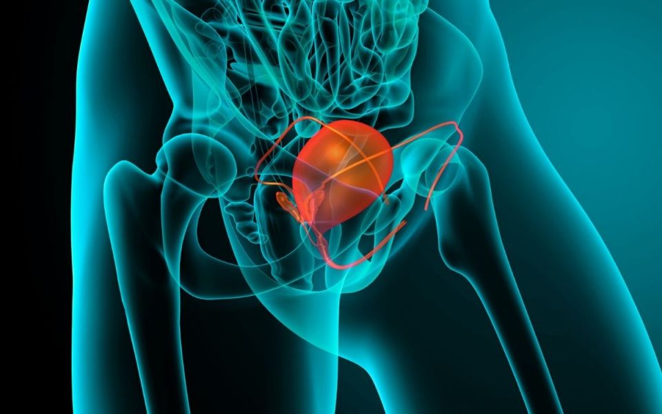 From Probing Prostates to Bladder Breakthroughs