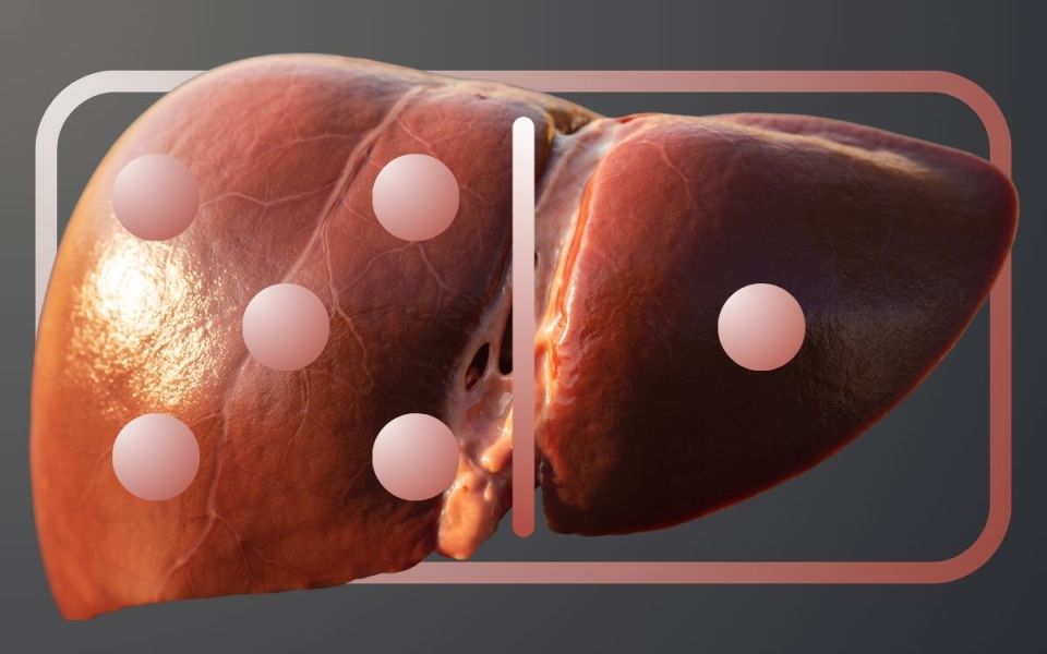 Liver Fats Domino Effect