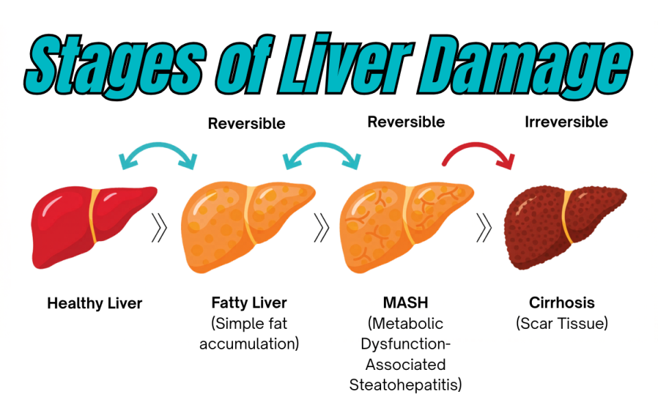 What Happens When Fat Builds Up in the Liver? The Liver Fats Domino Effect.