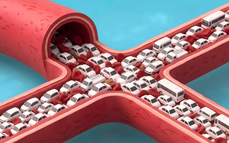 How Excess Body Fat Affects Blood Sugar Control